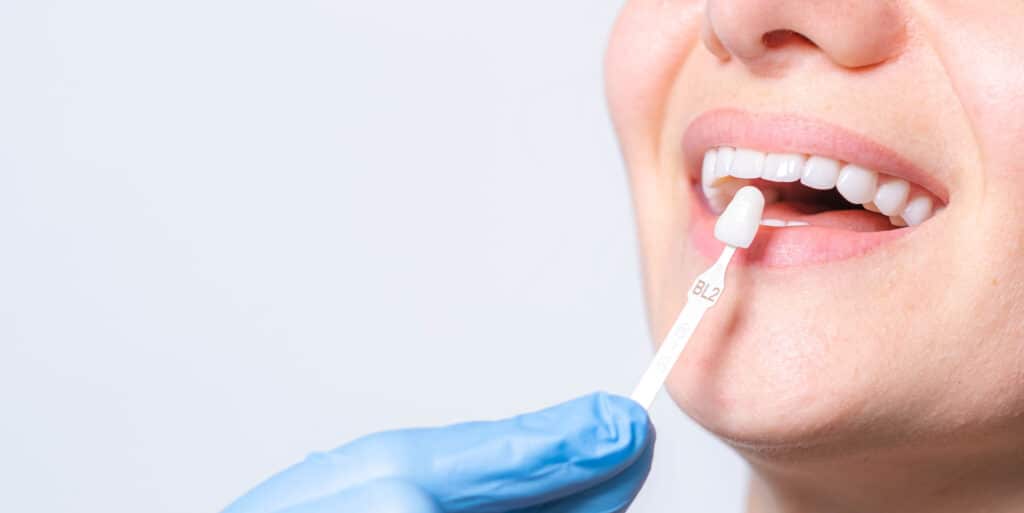patient choosing a dental crown color