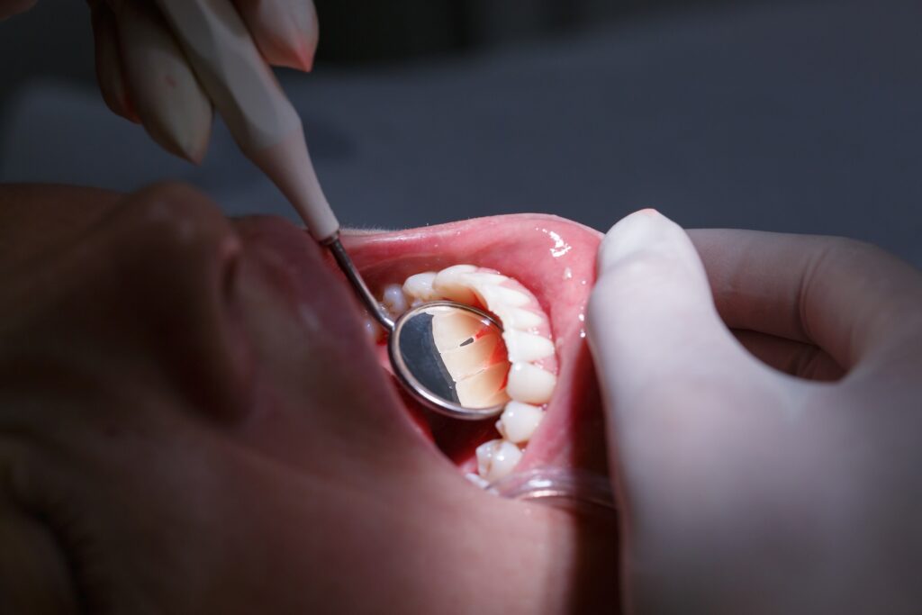 pateint having their teeth examined
