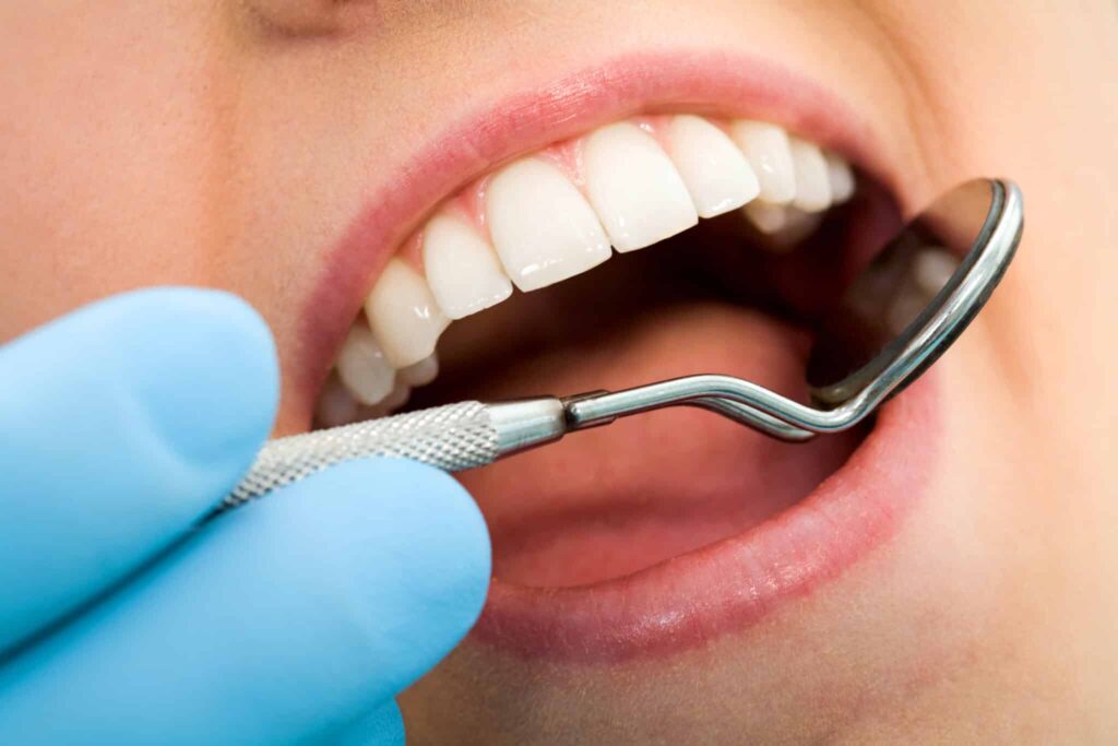 dentist inspecting the patinets teeth before a teeth cleaning